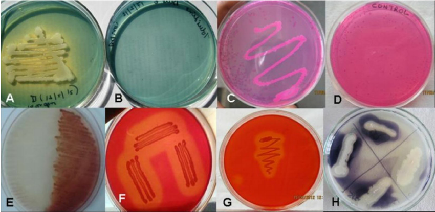 Industrial Enzymes for Cellulosic Sugars and Beyond by Matti Heikkilä 