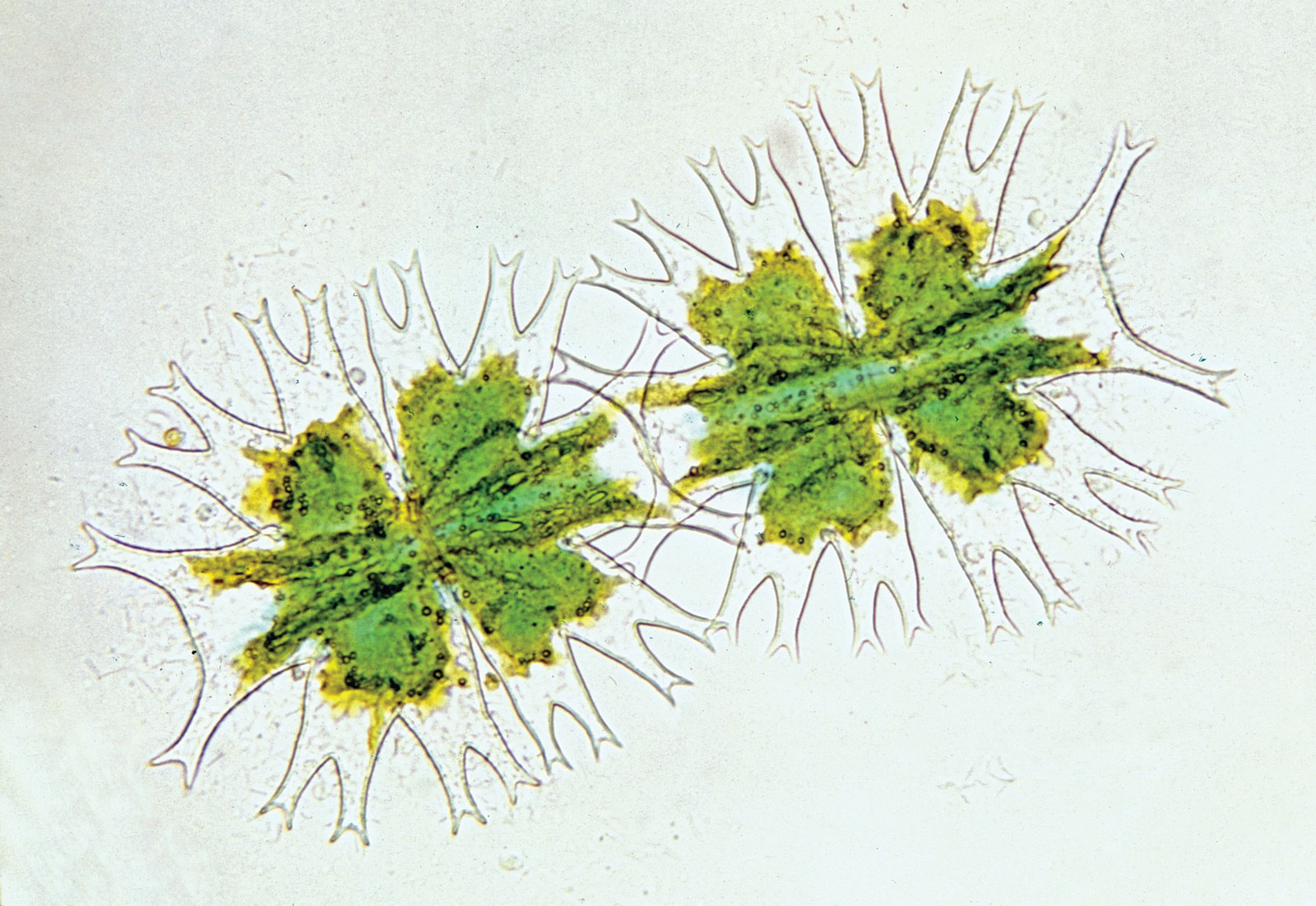 The Microscopic World of Algae