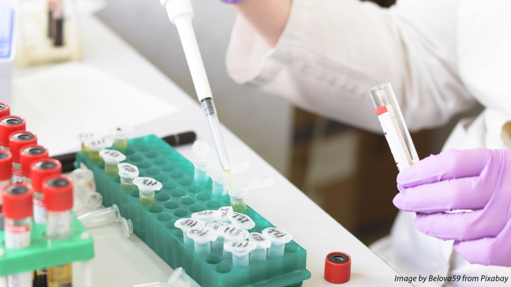 PLA Laboratory Components