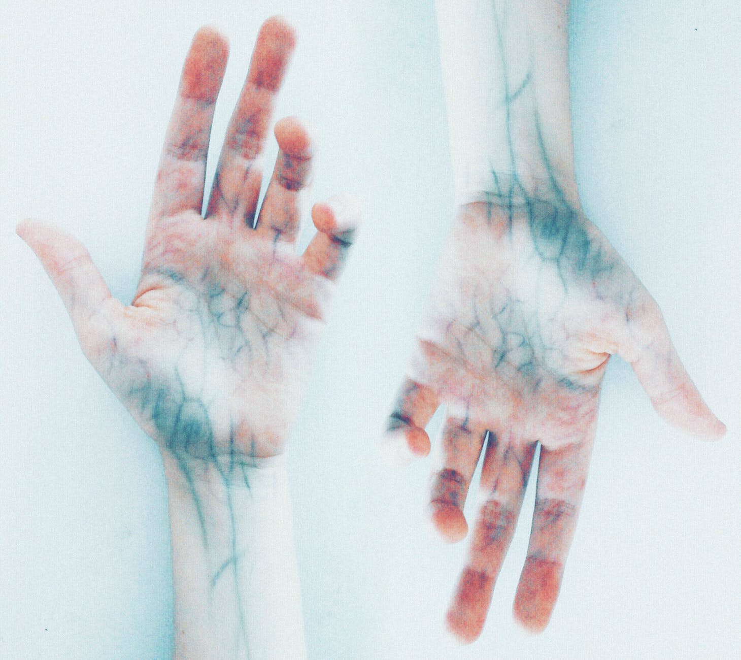 Scientists Discover Microplastics in Human Veins